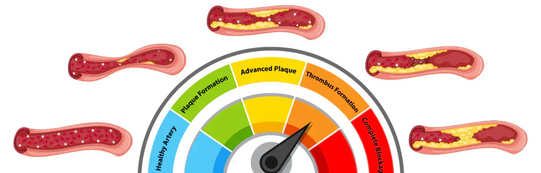 Como reduzir o colesterol mau
