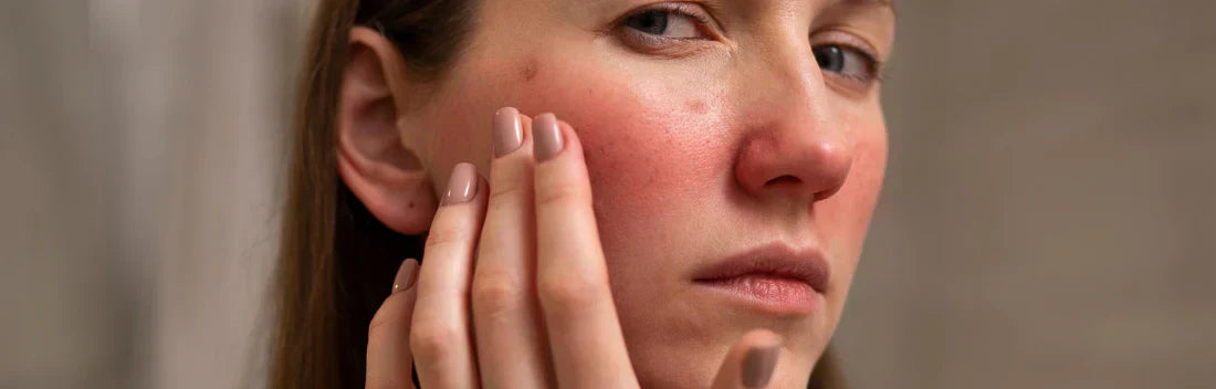 Pele reactiva e sensível