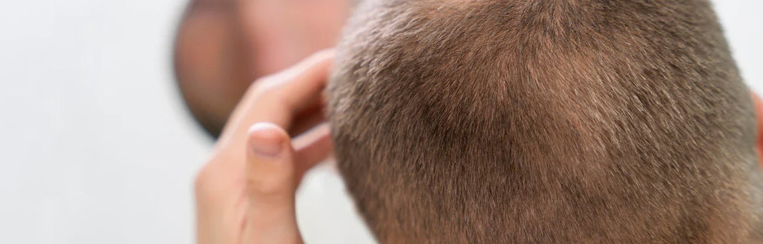 Os melhores tratamentos anticaída para o cabelo e como ajudam a fortalecê-lo