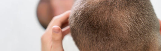 Os melhores tratamentos anticaída para o cabelo e como ajudam a fortalecê-lo