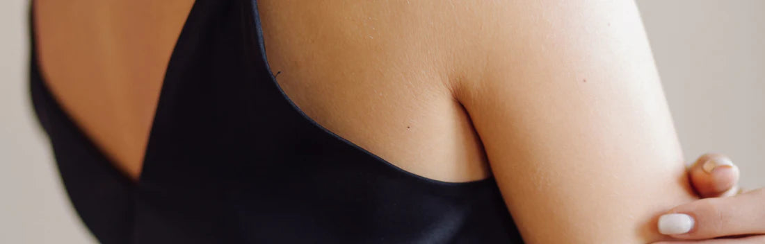 Queratose pilariana: Causas e cremes de tratamento