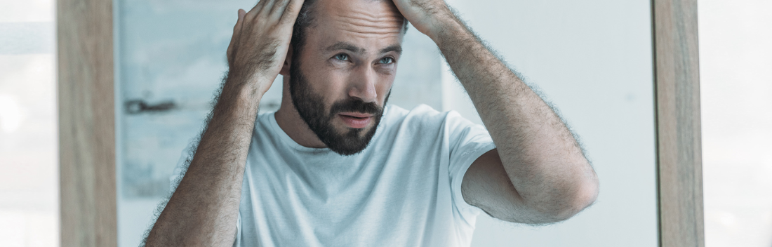 queda de cabelo nos homens