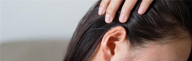 Queda de cabelo pós-parto, o que tomar?