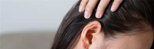 Queda de cabelo pós-parto, o que tomar?