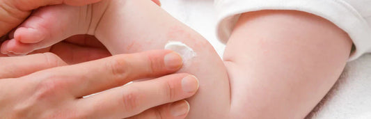 Sudamén em bebés: tratamento e cremes recomendados