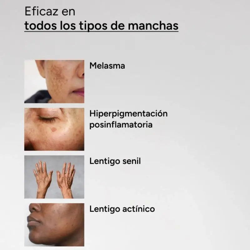 Acm Laboratoires Depiwhite Sérum Concentrado Anti-Manchas Intensivo, 30 ml