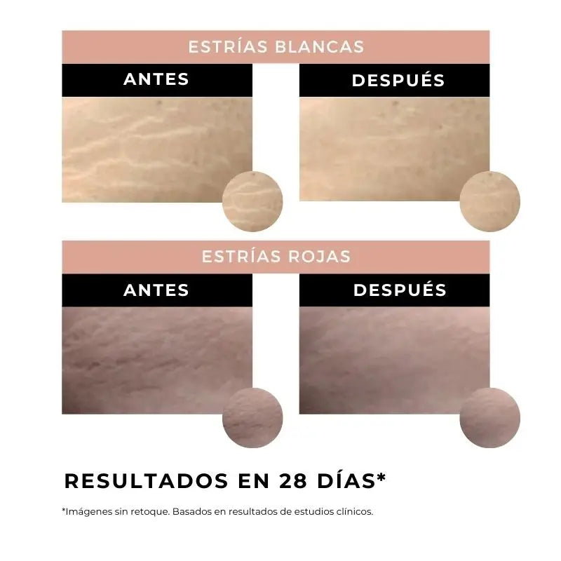 Arganour Creme Anti-Estrias Corporal, 100 Ml