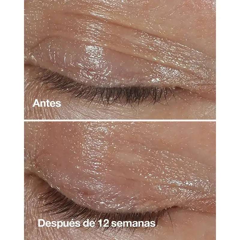 Clinique Smart Anti-Ageing Eye Contour, 15 ml