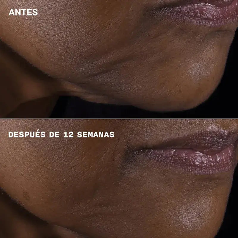 Clinique Smart Clinical Repair Anti-Aging Rosto e Pescoço, 50 ml