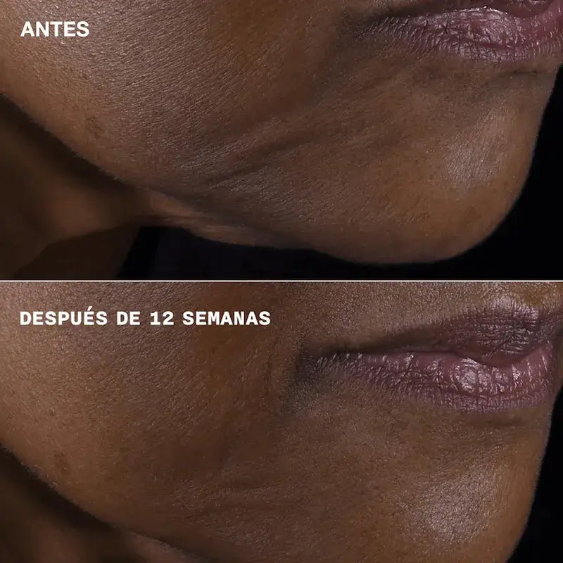 Clinique Smart Clinical Repair Refirmante + Lifting para Rosto e Pescoço, 75 ml