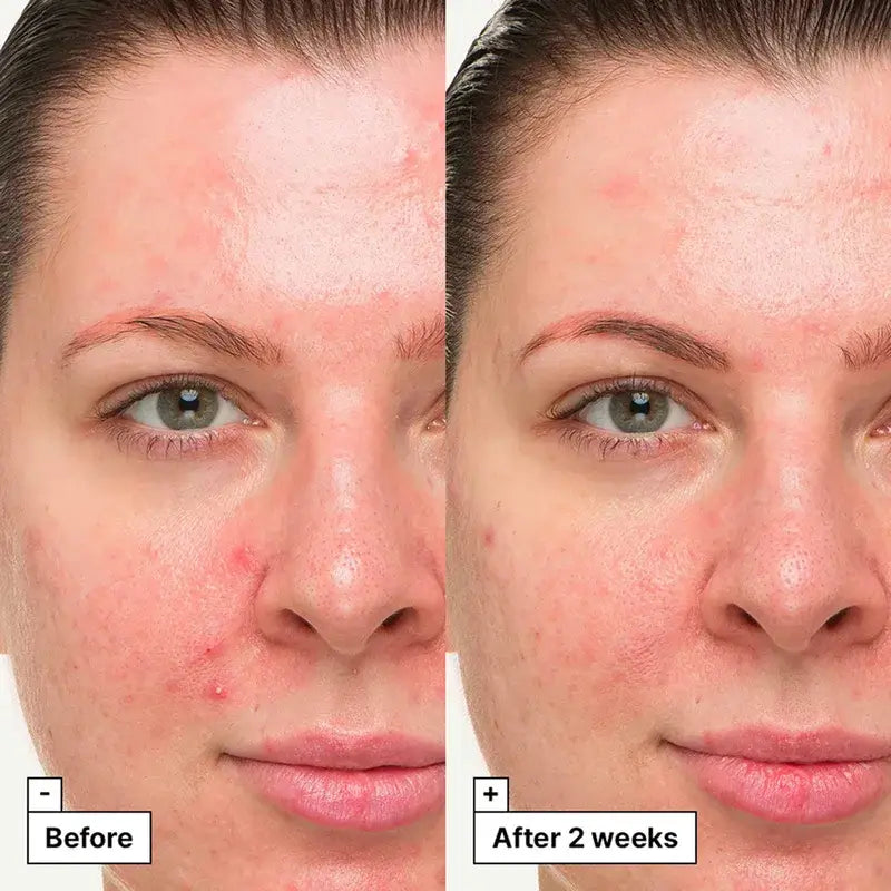 Dr.Jart+ Gel-Creme de Tratamento Suavizante, 30 ml