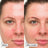 Dr.Jart+ Gel-Creme de Tratamento Suavizante, 30 ml