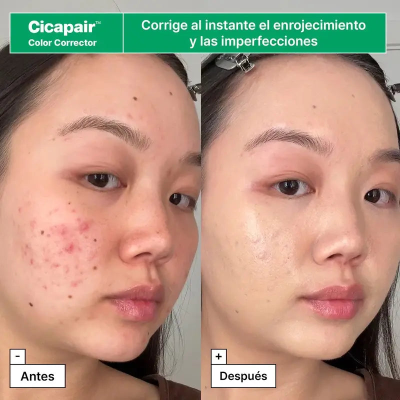 Dr.Jart+ Kit de Resgate para peles vermelhas com Centella asiatica