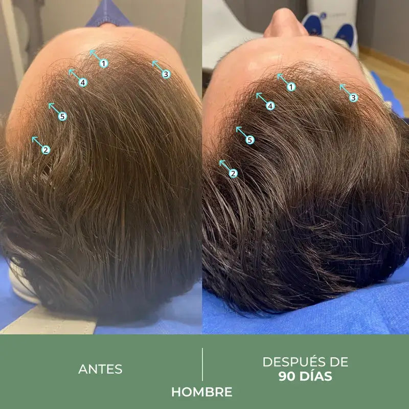 Ds Laboratories Revita Cbd Champô Anti-queda de Cabelo Antioxidante e Estimulante, 205 ml