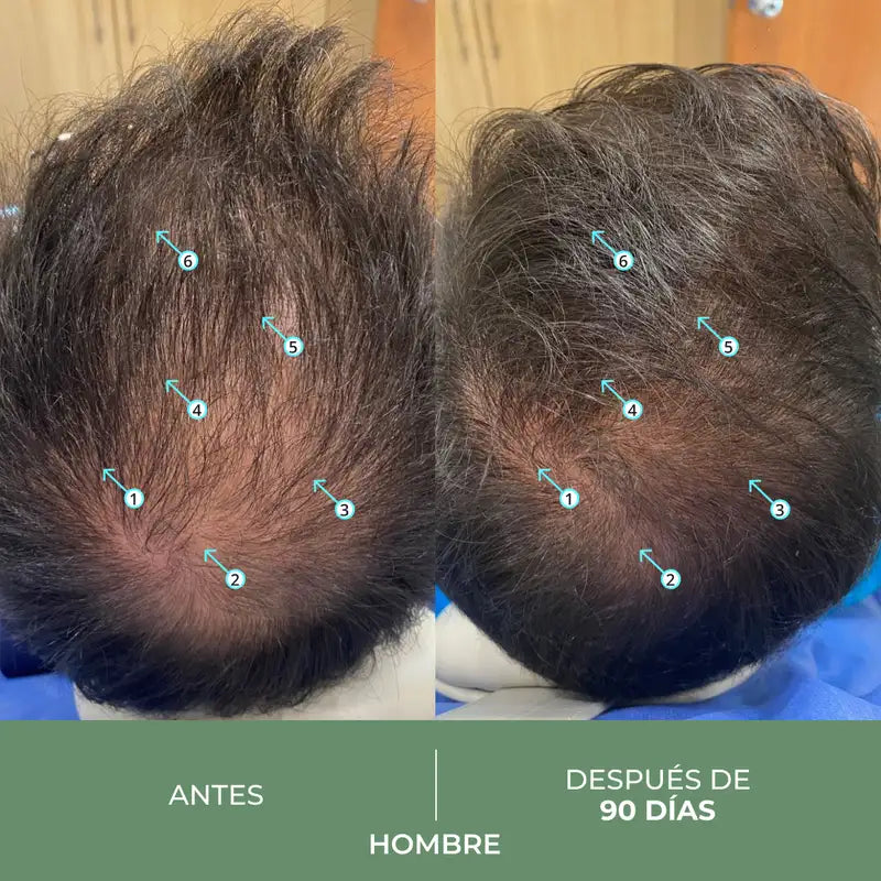 Ds Laboratories Revita Cbd Champô Anti-queda de Cabelo Antioxidante e Estimulante, 205 ml