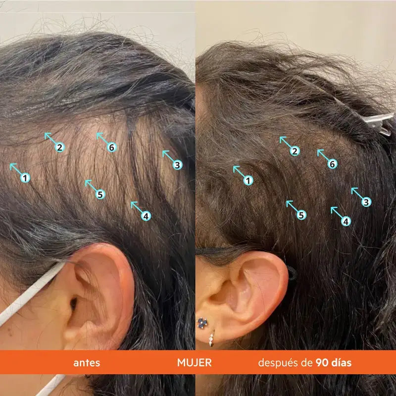 Ds Laboratories Revita Condicionador Estimulante Anti-Queda de Cabelo, 205 ml