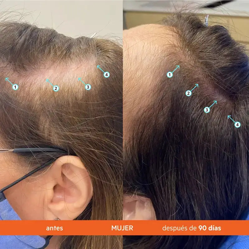 Ds Laboratories REVITA Champô estimulante da queda de cabelo 925ML