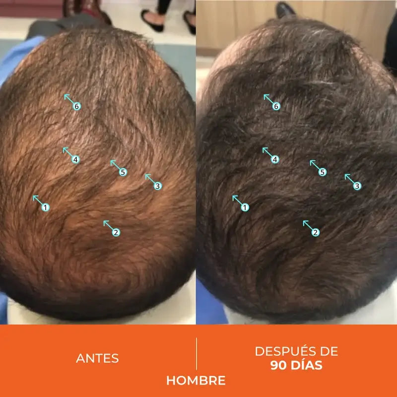 Ds Laboratories Revita Anti-Hair Loss Tablets, 90 unid.