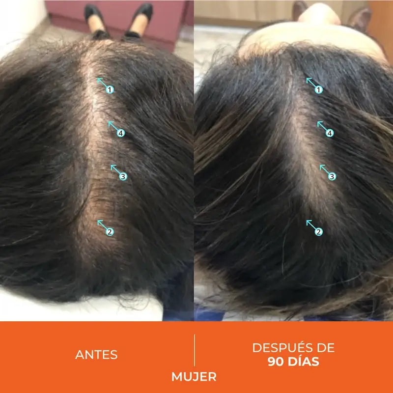 Ds Laboratories Revita Anti-Hair Loss Tablets, 90 unid.