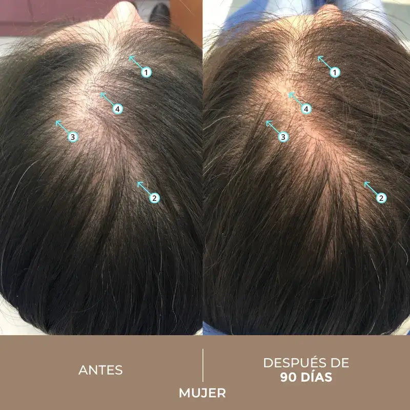 Ds Laboratories Spectral Lotion Spectral Dnc-N Nanoxidil® 5% Hair Loss Treatment, 60 ml