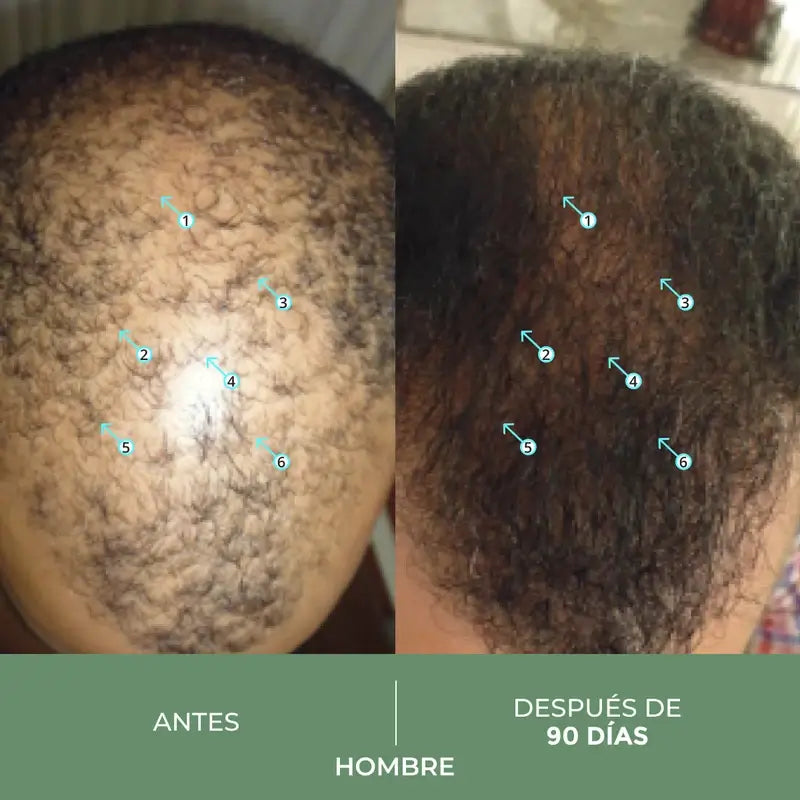 Ds Laboratories Spectral Cbd Loção para a queda de cabelo, 60 ml