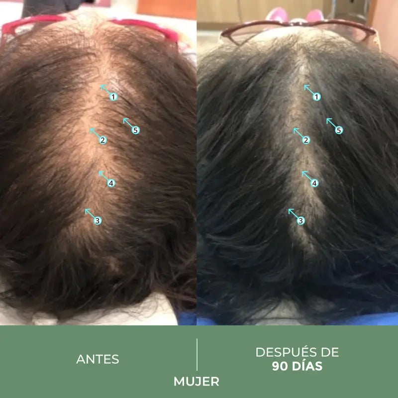 Ds Laboratories Spectral Cbd Loção para a queda de cabelo, 60 ml