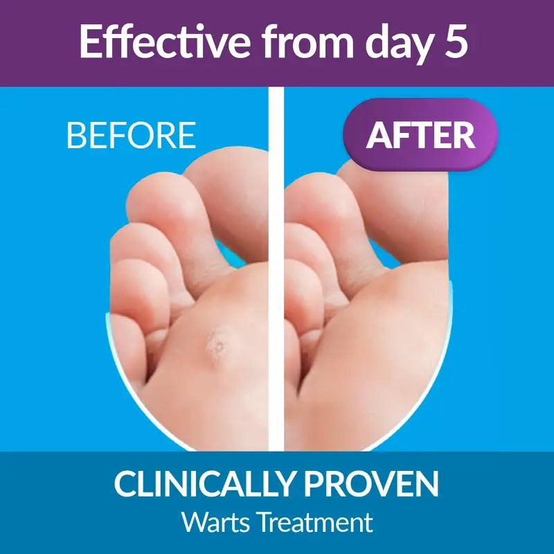 Excilor Pen Nail Mycosis Treatment, 3,3 ml