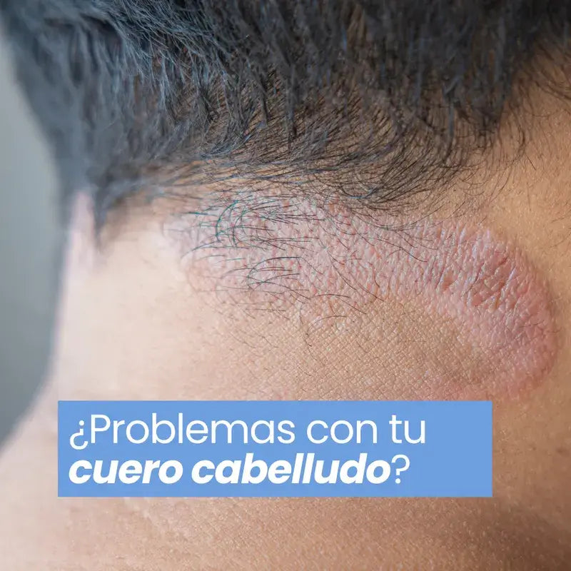 Champô Ervilha dos Cantos Verdes, 300ml