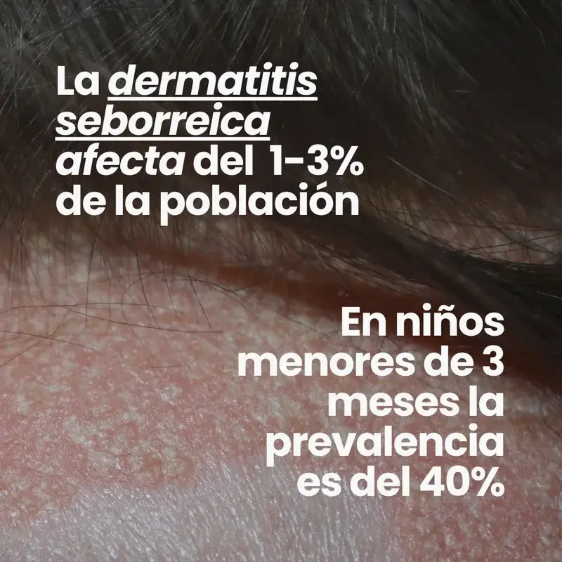 Champô Ervilha dos Cantos Verdes, 300ml