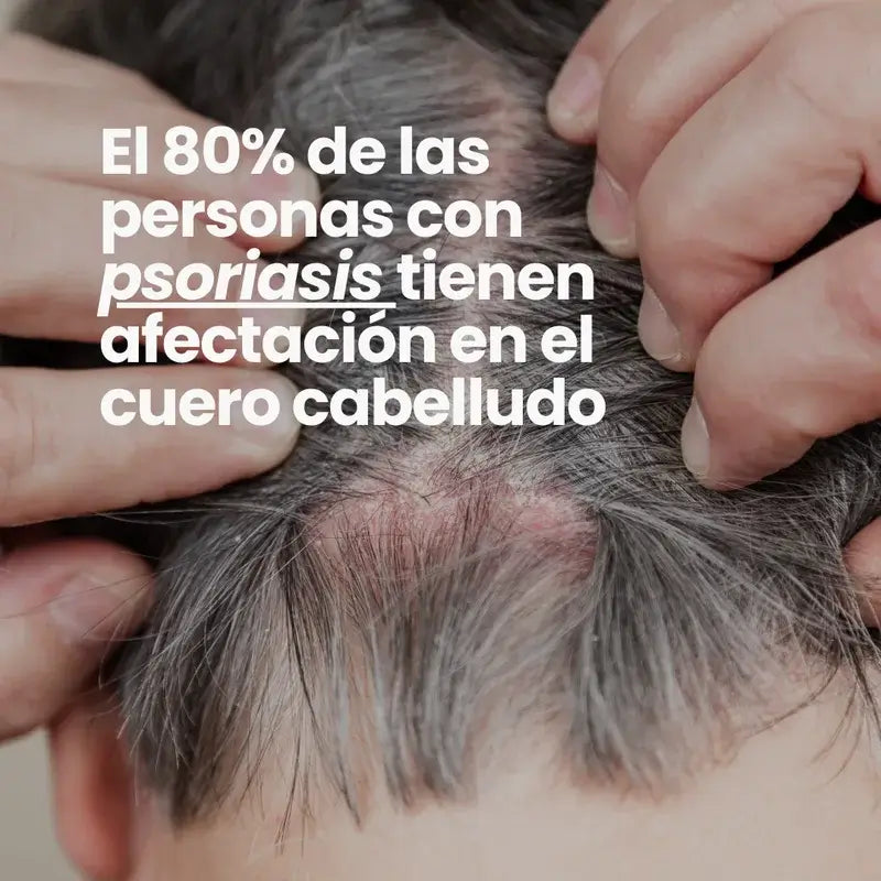 Champô Ervilha dos Cantos Verdes, 300ml