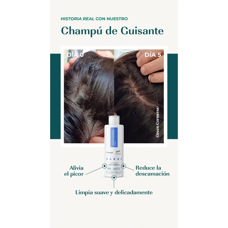 Champô Ervilha dos Cantos Verdes, 300ml