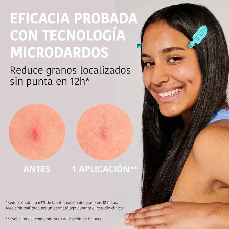 Patches para pele com tendência para o acne Iroha Nature Microdart Pimples, 12 unidades