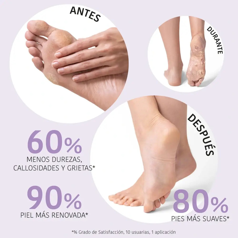 Iroha Nature Corporal Socks Máscara Esfoliante e Esfoliante, 20 Ml