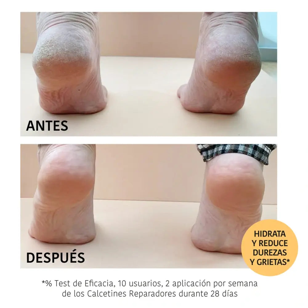 Iroha Nature Máscara Meias Reparadoras Corporais, 20 Ml