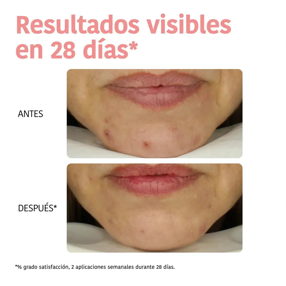 Iroha Nature Facial Peeling Tissue Mask - Ácido Glicólico , 23 ml