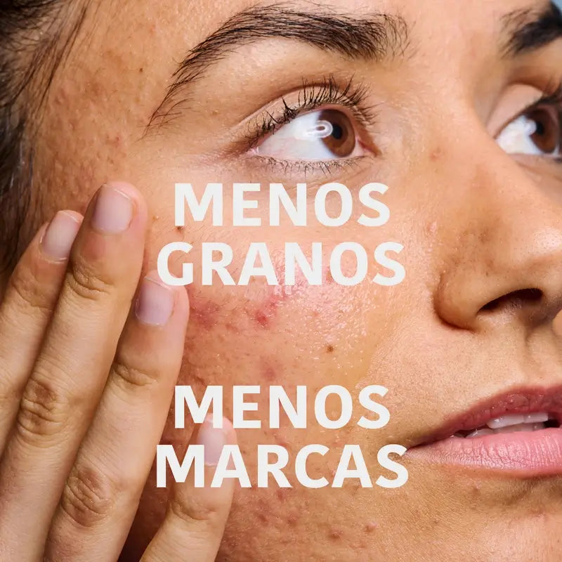 Iroha Nature Soro Anti-Imperfeições para Pele Oleosa, 30 ml