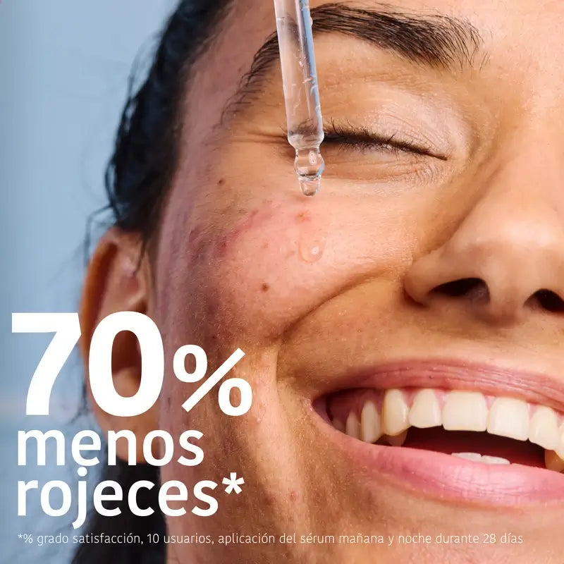 Iroha Nature Soro Anti-Imperfeições para Pele Oleosa, 30 ml