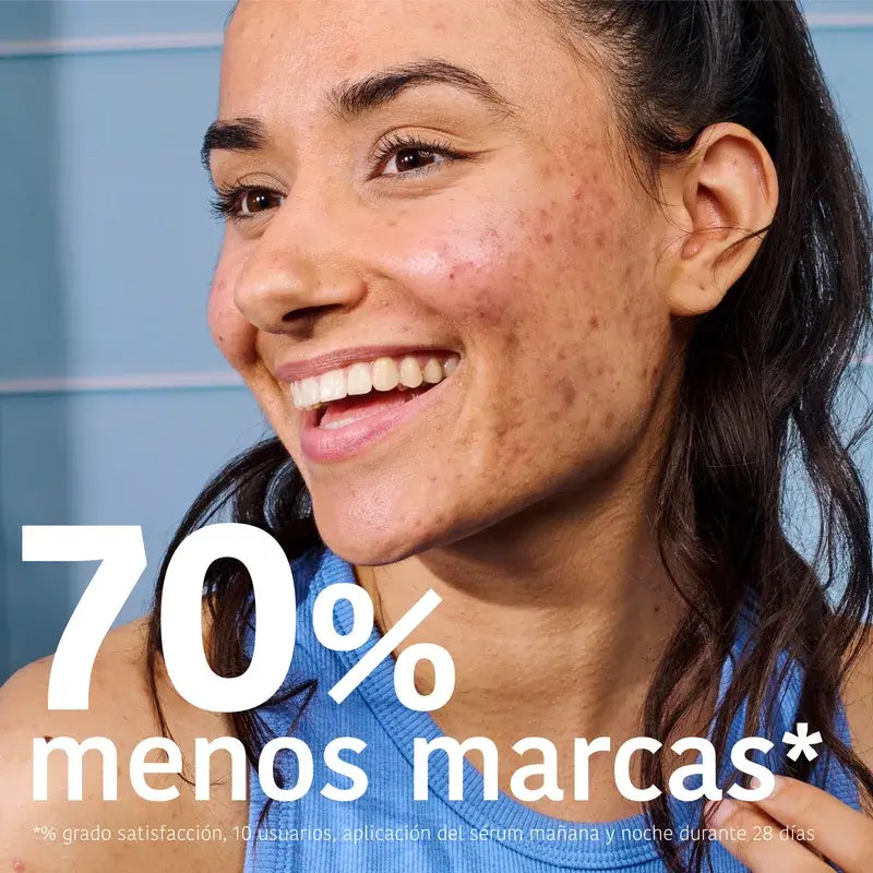 Iroha Nature Soro Anti-Imperfeições para Pele Oleosa, 30 ml