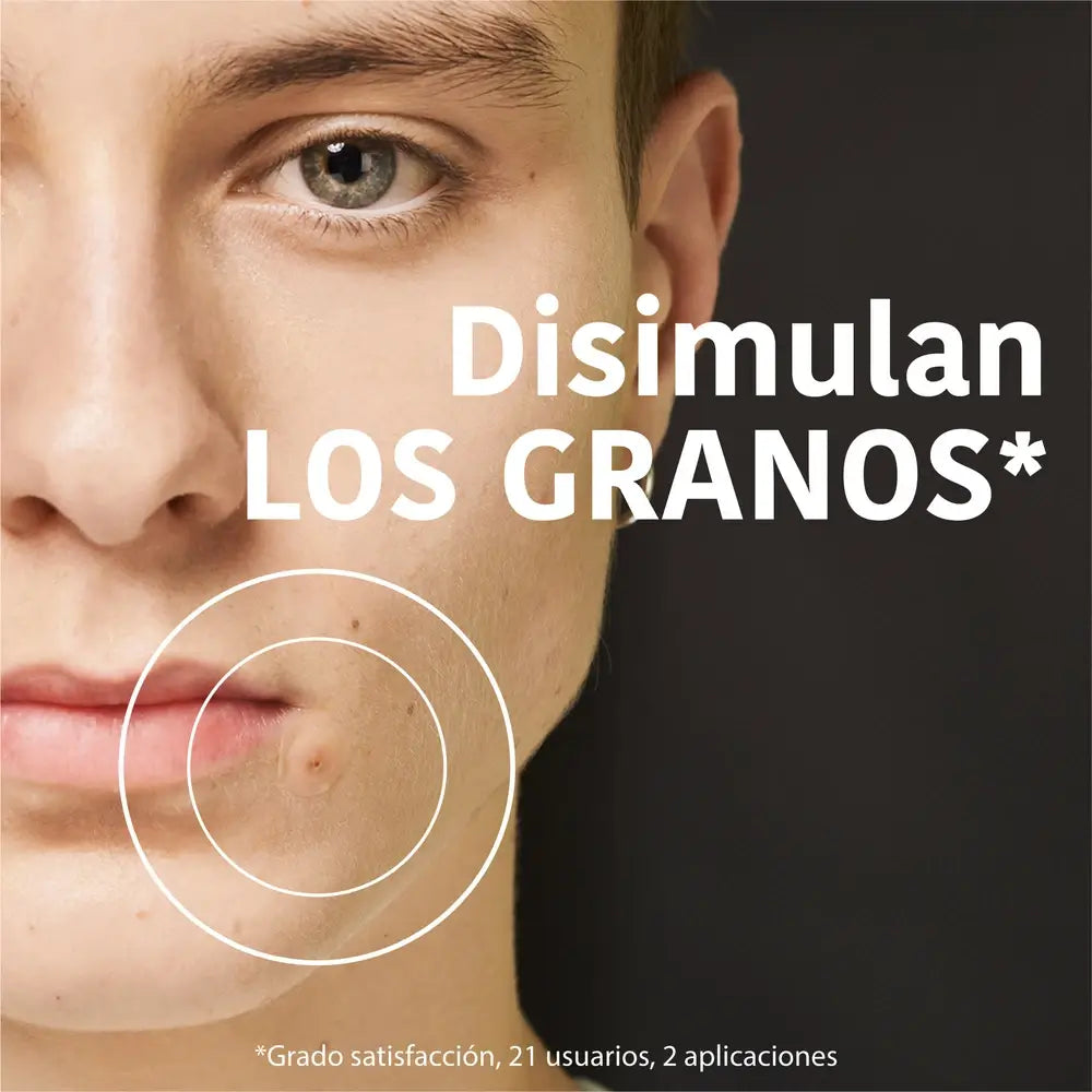 Iroha Nature Sos Patches para Espinhas - Ácido Salicílico, 18 unid.