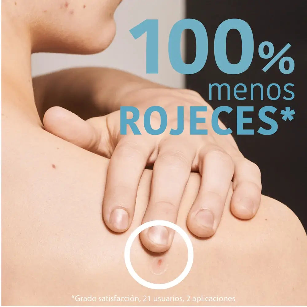 Iroha Nature Sos Patches para Espinhas - Ácido Salicílico, 18 unid.