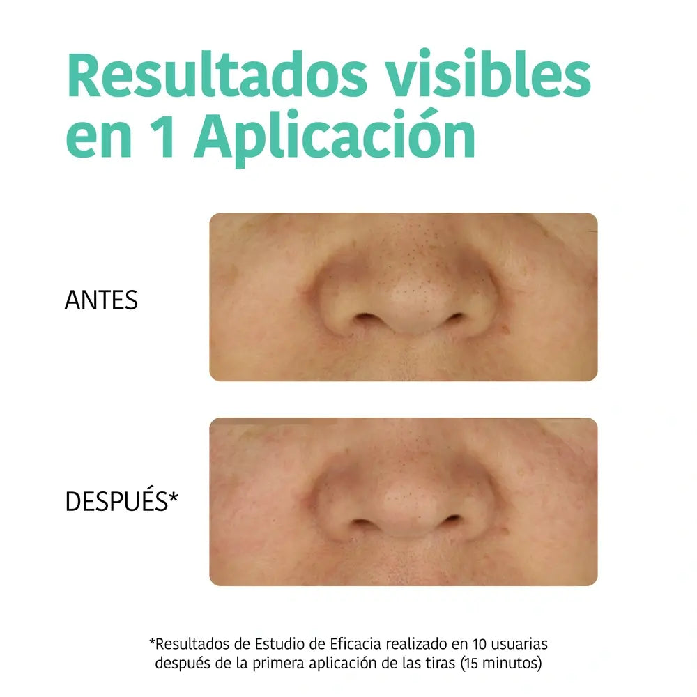 Iroha Nature Tiras de Limpeza Profunda para o Nariz Cravos Pretos - Carvão Vegetal, 5 unid.