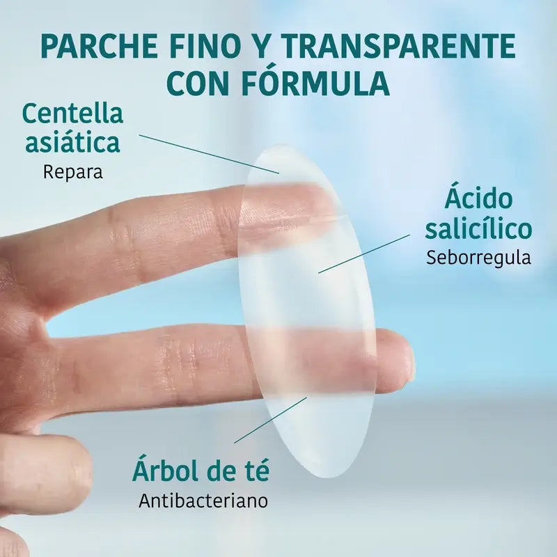 Iroha Nature Xl Pimple Patch , 5 unidades