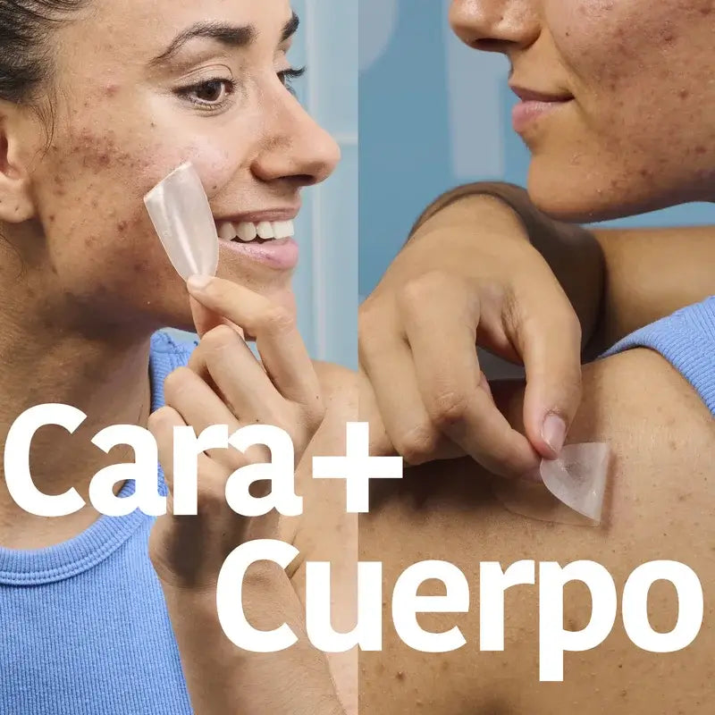 Iroha Nature Xl Pimple Patch , 5 unidades