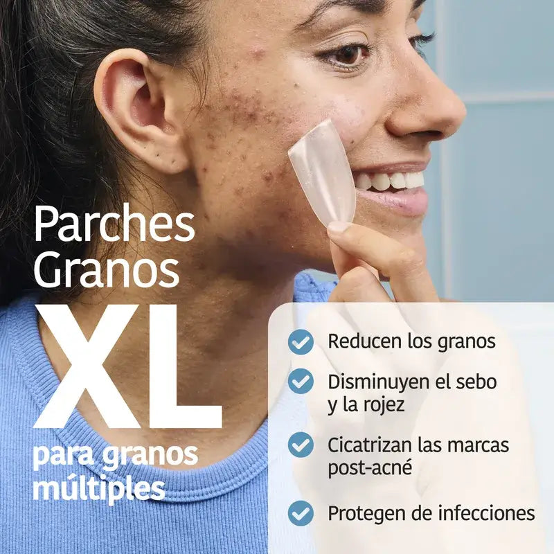Iroha Nature Xl Pimple Patch , 5 unidades