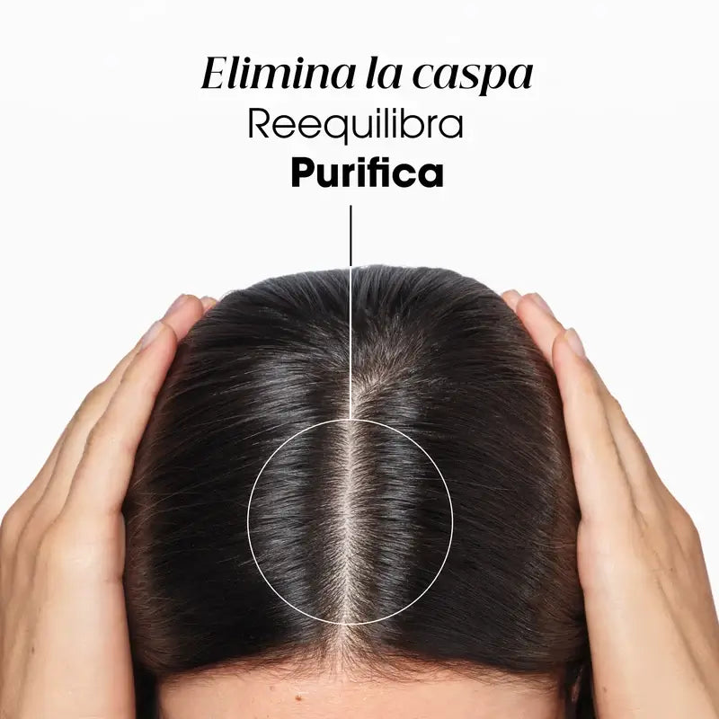 Klorane Champô de Tratamento Anti-Caspa Reequilibrante A La Galanga, 400 ml