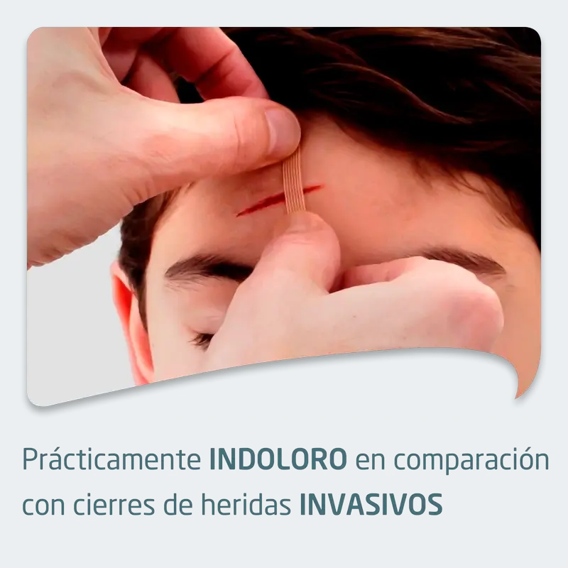 Leukoplast Leukosan Strip, 6 Mm X 38 Mm / 6 Mm X 75 Mm, 2 Unidades