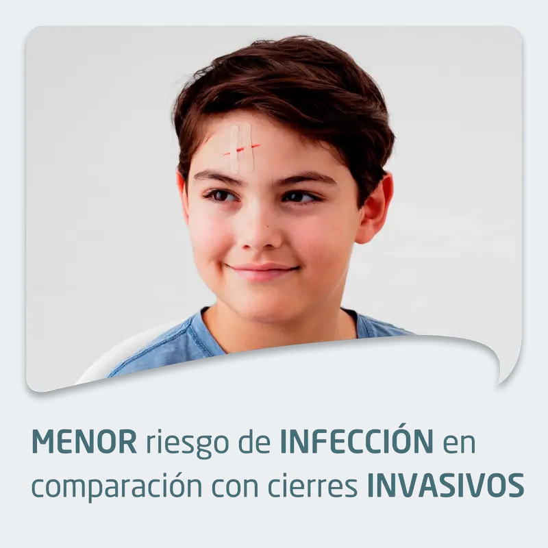 Leukoplast Leukosan Strip, 6 Mm X 38 Mm / 6 Mm X 75 Mm, 2 Unidades