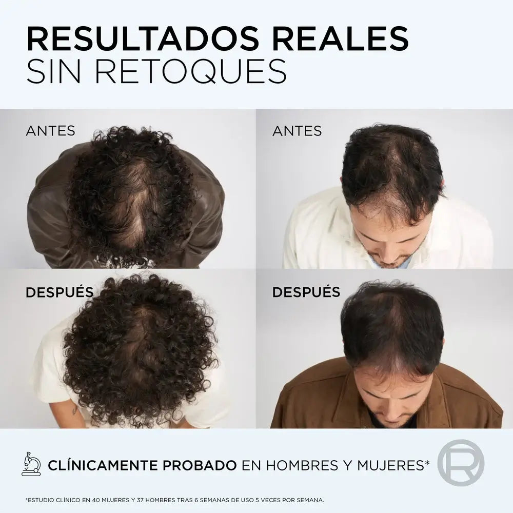 L'Oreal Paris Elvive Sérum Anti-Queda Potenciador do Crescimento, 102 ml