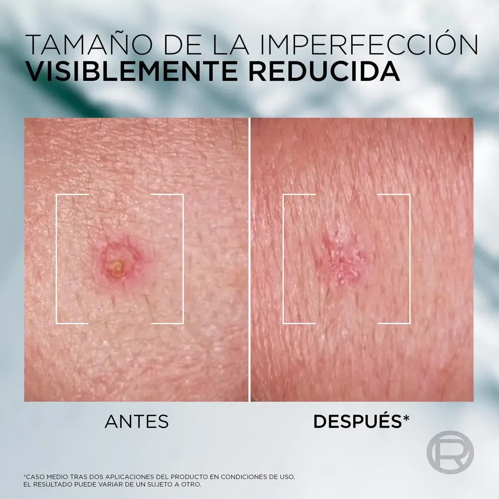 L'Oreal Paris Men Expert Sos Paste Derma Control, 45 ml