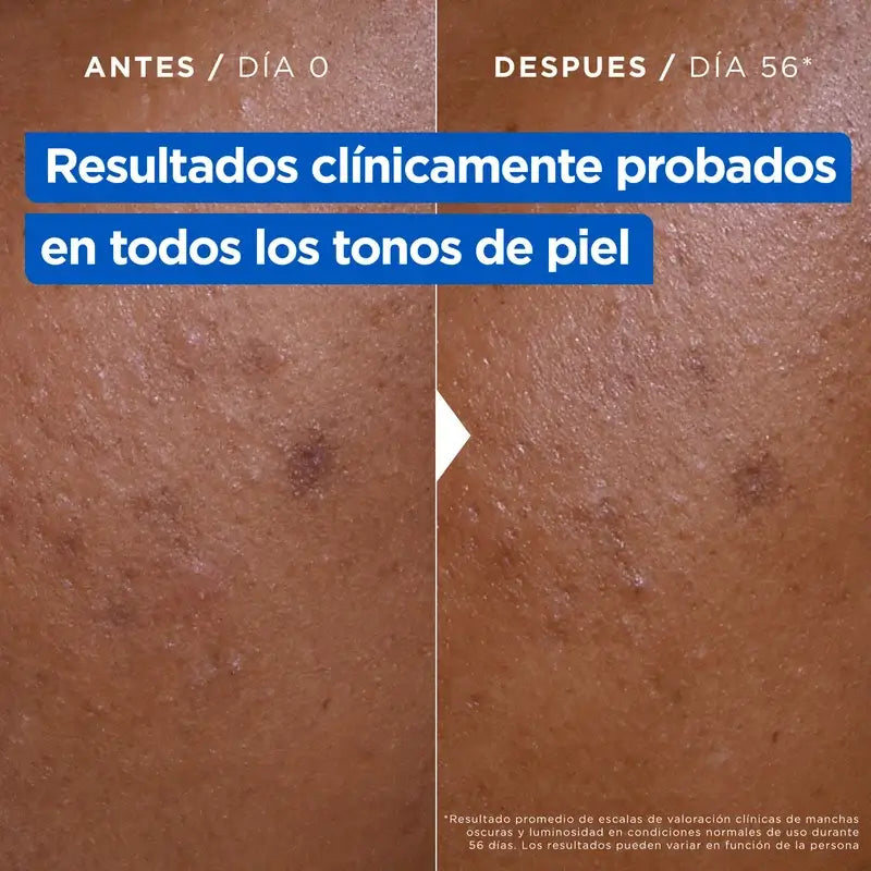 Mixa Niacinamide Stain Cream, 400 ml